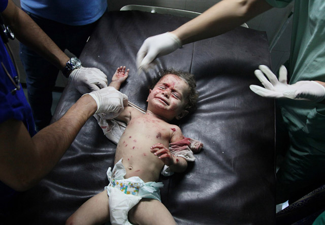 Injured Palestinians taken to hospital after Israeli airstrikes