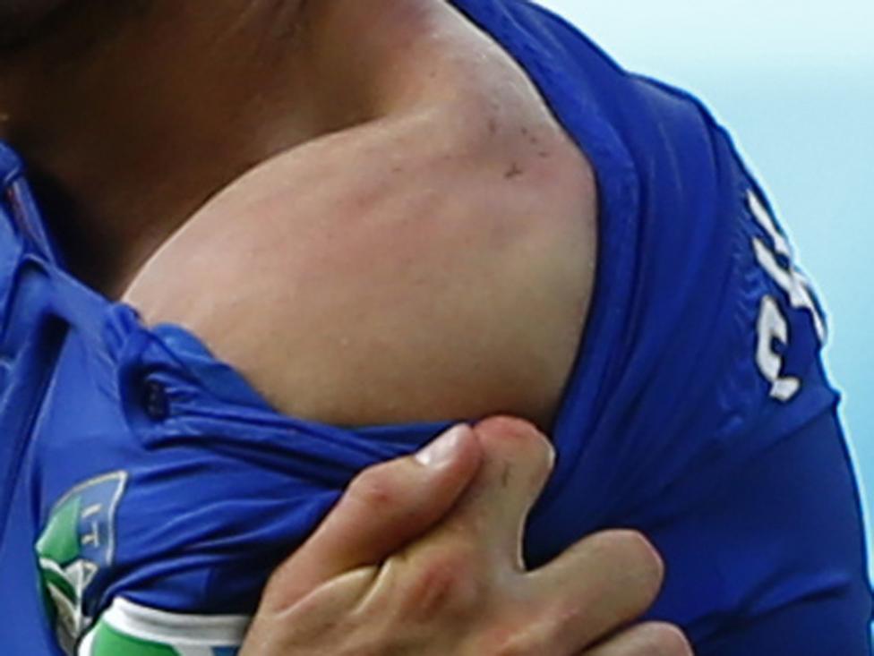 Italy's Chiellini shows his shoulder, claiming he was bitten by Uruguay's Luis Suarez, during their 2014 World Cup Group D soccer match at the Dunas arena in Natal