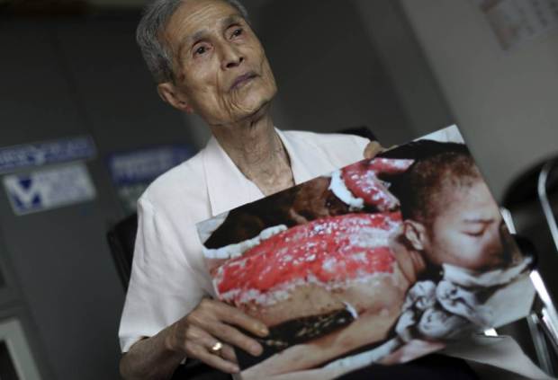 In this June 30, 2015 photo, Sumiteru Taniguchi, 86, a survivor of the 1945 atomic bombing of Nagasaki, shows a photo of himself taken in 1945, during an interview at his office in Nagasaki, southern Japan. For 70 years, Taniguchi, chairman of the Nagasaki Atomic Bomb Survivors Council, has lived a web of wounds covering most of his back, and the remains of three ribs that half rotted away and permanently press against his lungs, making it hard to breathe. His wife still applies a moisturizing cream every morning to reduce the irritation from the scars. (AP Photo/Eugene Hoshiko)