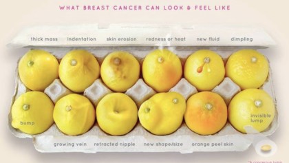 Imagen viral del cáncer de mama