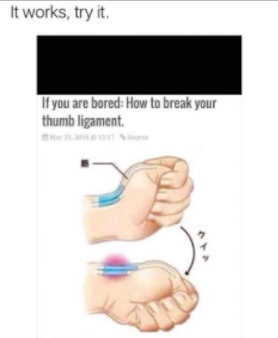 Cómo romperse los tendones - Meme