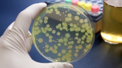 Microbios - Laboratorio