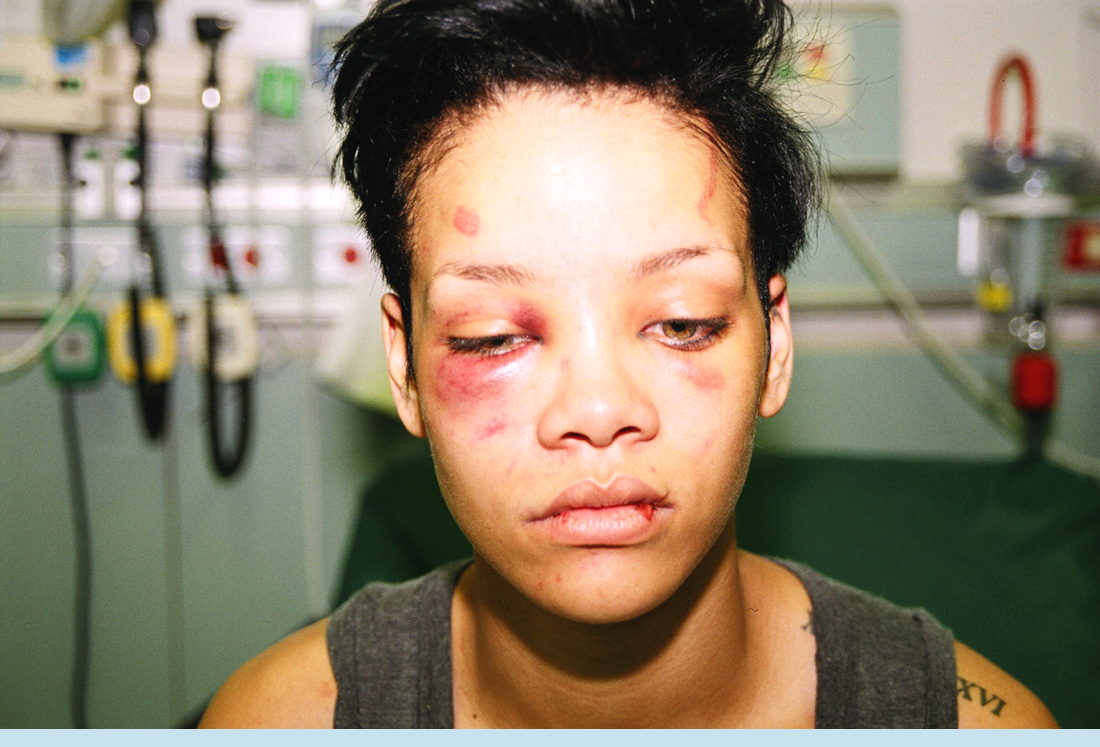 rihanna es golpeada por Chris Brown