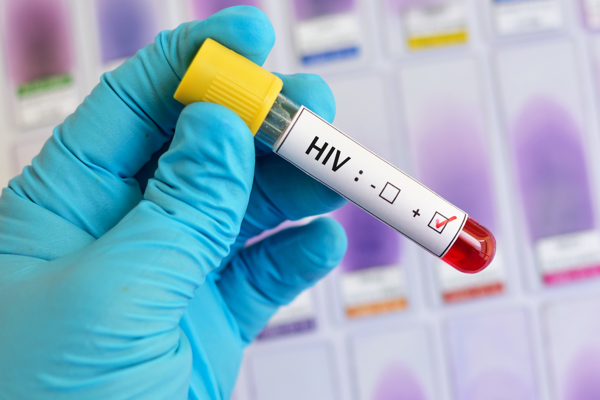 En 2019 probarán en humanos las vacunas contra el VIH