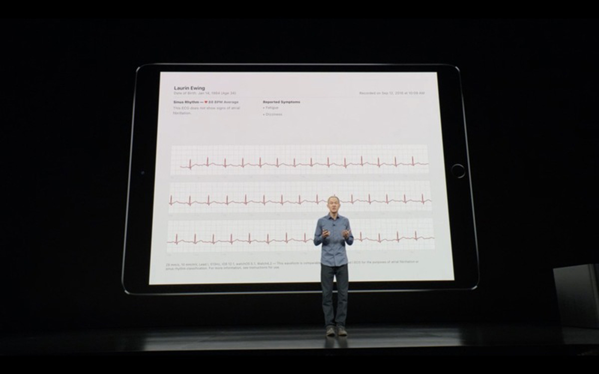 Apple Watch 4 te puedes hacer un electrocardiograma