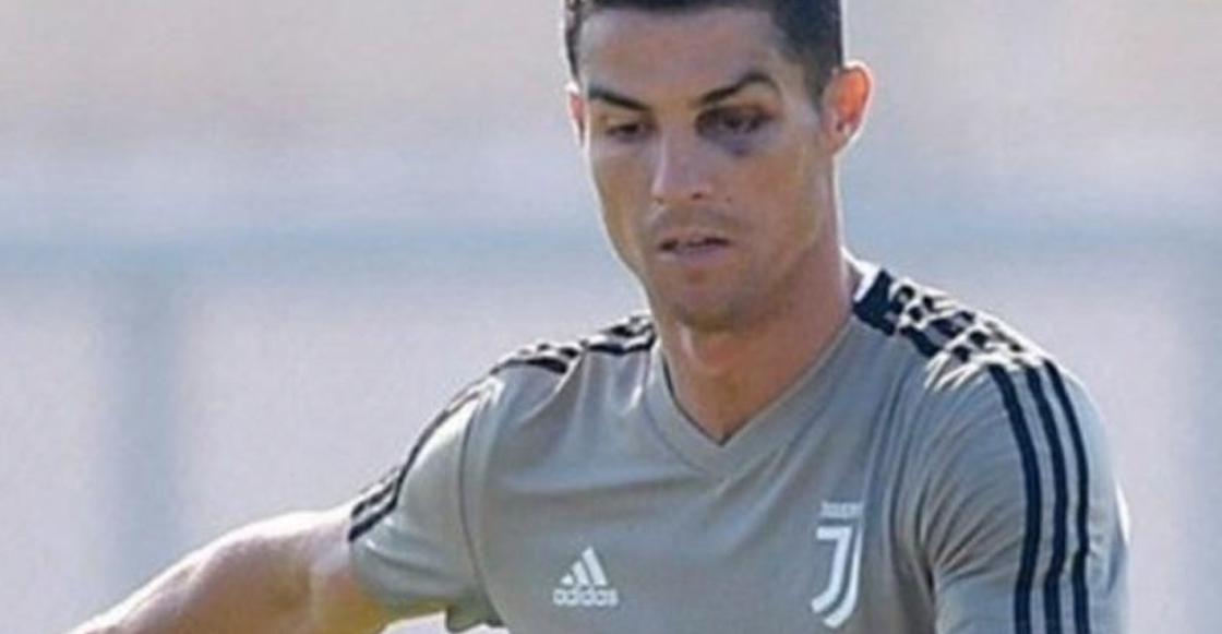 ¿Por qué llegó Cristiano Ronaldo al entrenamiento con el ojo morado?