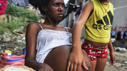 ¿Epidemia de cesáreas? América Latina lidera lista de las regiones con mayor tasa