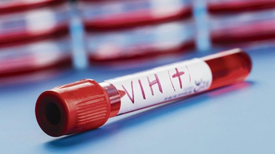 Milagros inesperados: Las células madre podrían curar el VIH