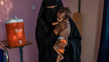Han muerto de hambre casi 85 mil niños por conflicto en Yemen: Save The Children