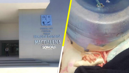 México Mágico: usan garrafón como incubadora en un hospital de Sonora