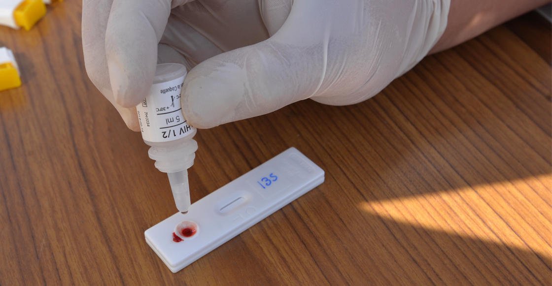 Es discriminatorio que el IMSS pida exámenes de VIH/SIDA como requisito de contratación