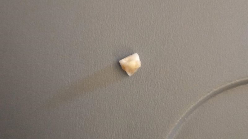 ¡Qué asco! Un pasajero de avión encontró un diente en su comida