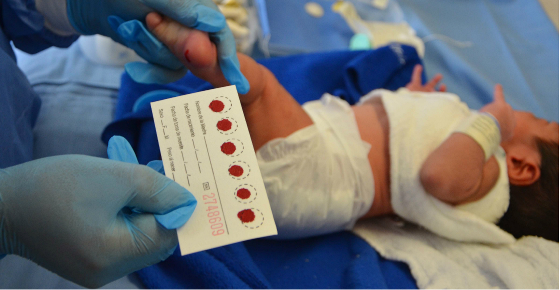 ¿La prueba de tamiz neonatal fue suspendida por la Secretaría de Salud?