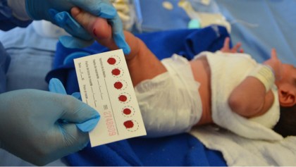 ¿La prueba de tamiz neonatal fue suspendida por la Secretaría de Salud?