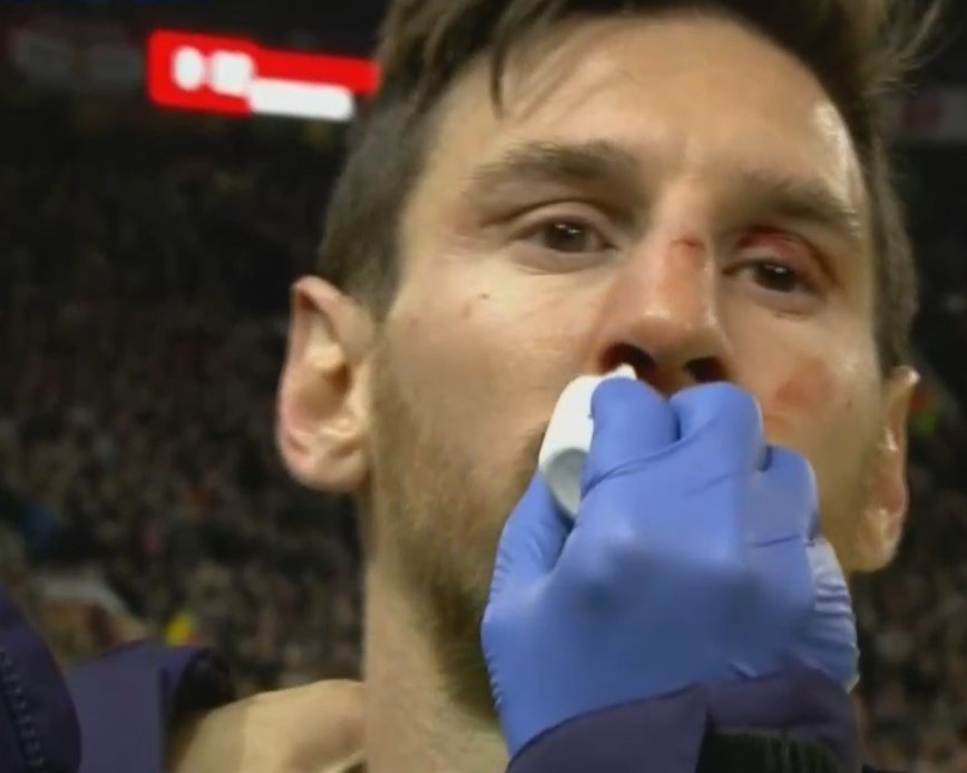 En imágenes: El 'golpazo' de Smalling que hizo sangrar a Messi