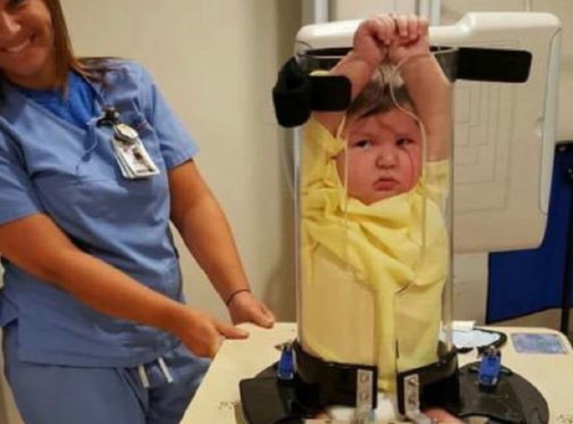 Este dispositivo inmoviliza niños durante los rayos X