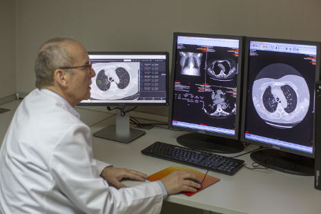 Una inteligencia artificial detecta el cáncer de pulmón con mayor precisión que los médicos 