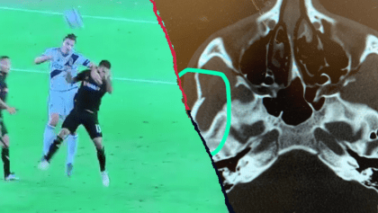 El codazo de Ibrahimovic que le costaría una fuerte sanción en la MLS