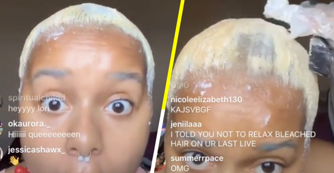 Youtuber se graba mientras se decolora el cabello y se queda sin pelo en plena transmisión