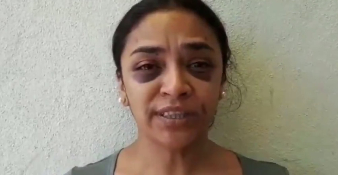 Mitzi es una reportera que denunció un intento de violación y terminó golpeada por la policía