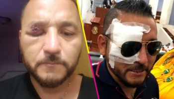 "El Mijis" fue atacado a pedradas al salir del Congreso de San Luis Potosí