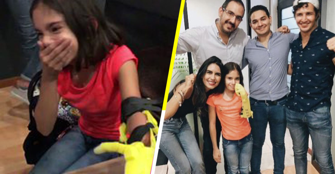 Conoce el proyecto mexicano que está haciendo prótesis de bajo costo para niños