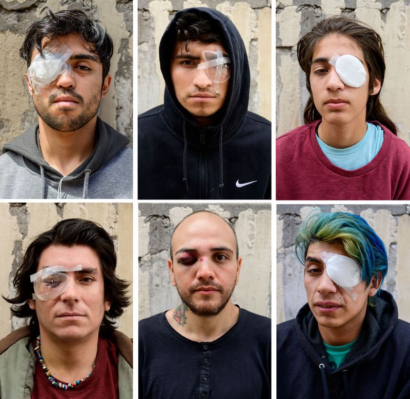 chile-policia-ojos-manifestantes-protesta-ciego-pinera-derechos-humanos-02