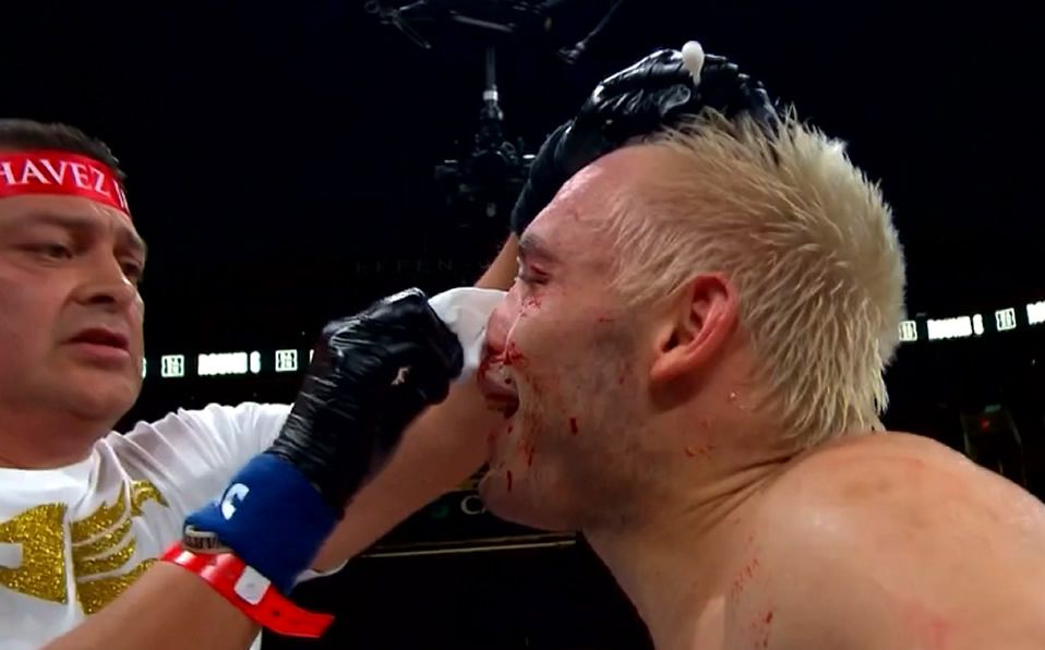 ¿Neta? Chávez Jr. cree que su carrera aún no ha terminado pese a la derrota con Jacobs