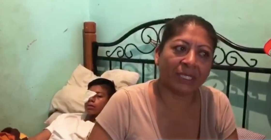 Niño de Chiapas es golpeado por sus compañeros; podría quedar ciego si no paga una operación de 55 mil pesos
