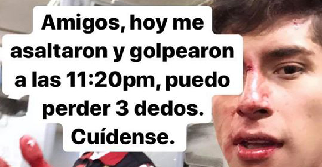 Estudiante del IPN sufre violento asalto en el Metro y narra cómo sucedió