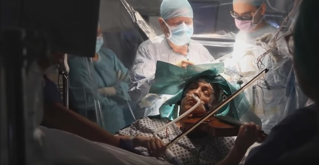 VIDEO: Mujer toca el violín mientras la operan para remover un tumor cerebral