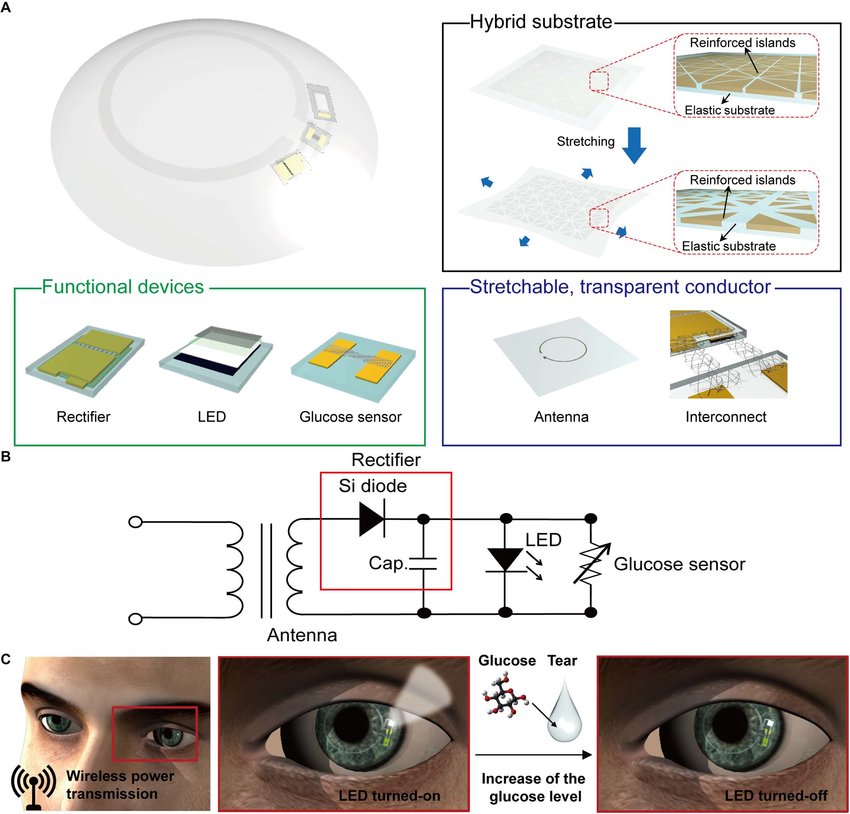 ¡Adiós a los pinchazos! Desarrollan lentes de contacto para monitorear la diabetes 