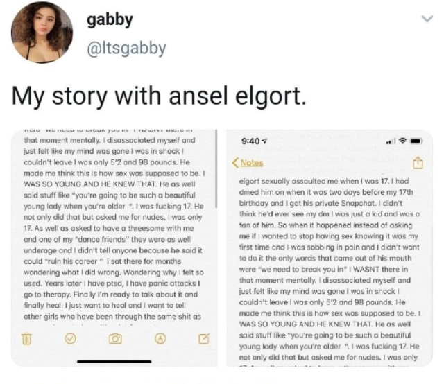 Acusan a Ansel Elgort de abusar sexualmente de una menor de edad