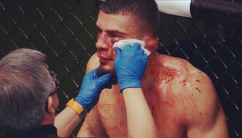 ¡Terrorífico! Peleador de la UFC ganó combate tras desprenderle la oreja a su rival