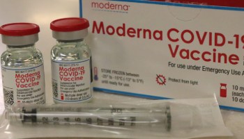Médico de EU sufre reacción alérgica "severa" tras recibir la vacuna de Moderna contra COVID-19