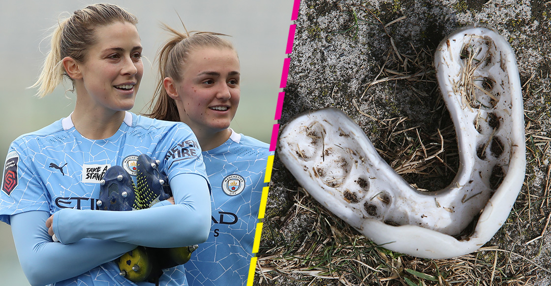 Premier League analiza uso de protectores bucales para evitar enfermedades