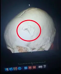 agresion-perro-chihuahua-delicias