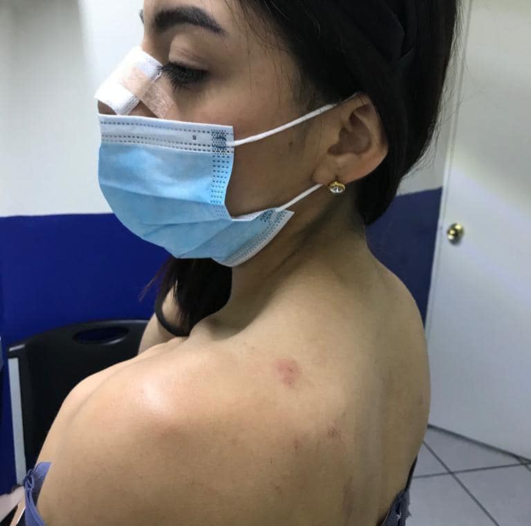 #JusticiaParaRodolfo: Novia de joven que mató a perrito dice que el animal la atacó