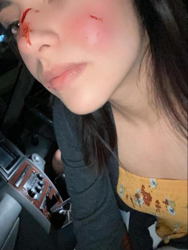 #JusticiaParaRodolfo: Novia de joven que mató a perrito dice que el animal la atacó