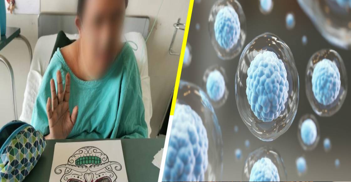 ¡Aplausos para Silverio! Paciente con Síndrome de Down se recupera de COVID-19