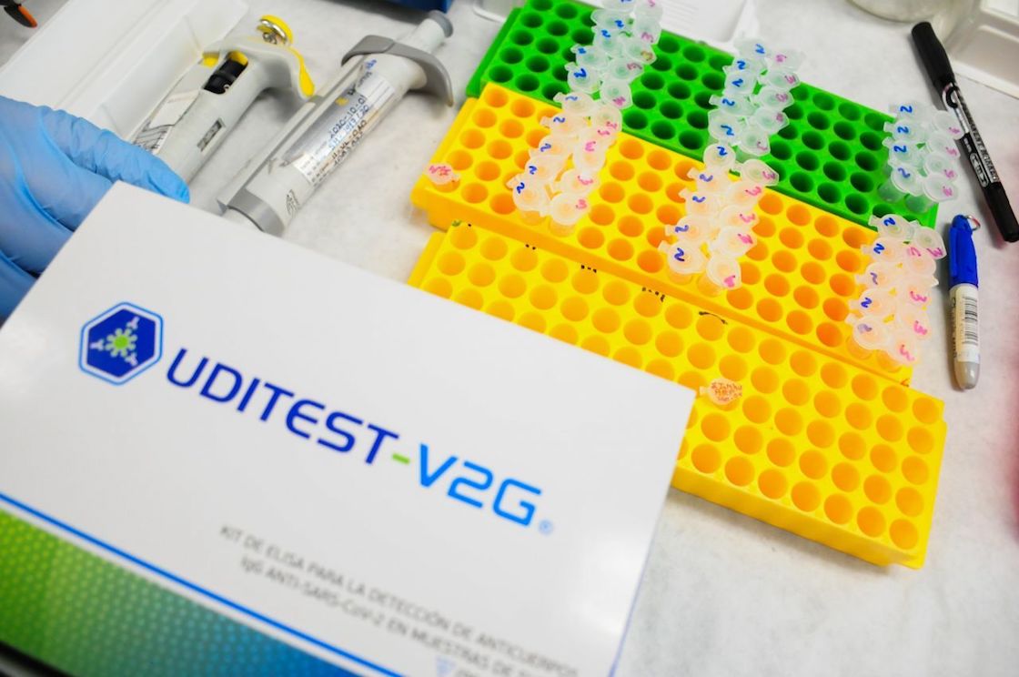 prueba-anticuerpos-covid-ipn