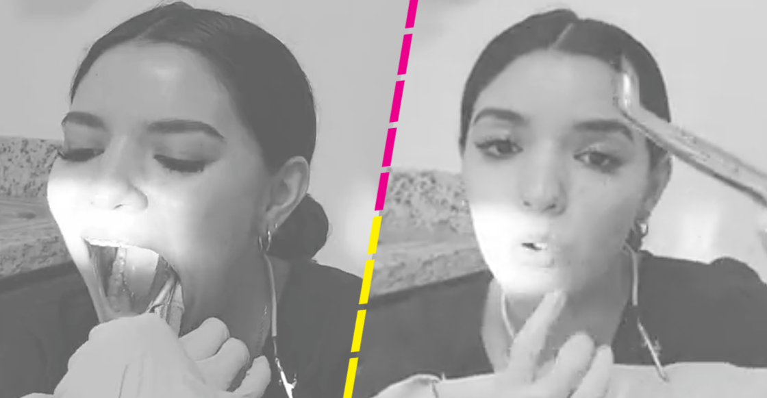 ¿¡Quéee!? Joven se quita las muelas del juicio en video y no podemos creerlo