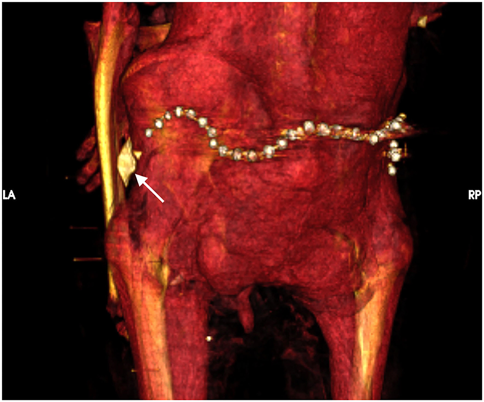 tomografia-faraon-amuletos-cinturon