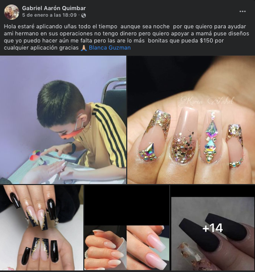 ¡Admirable! Niño pone uñas acrílicas para ayudar a pagar operación de su hermanito