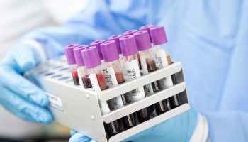 sangre-muestras-laboratorio