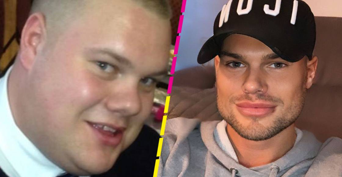 Joven gasta 700 mil pesos en cirugías para "ser perfecto" (y esta es su reflexión sobre la belleza)