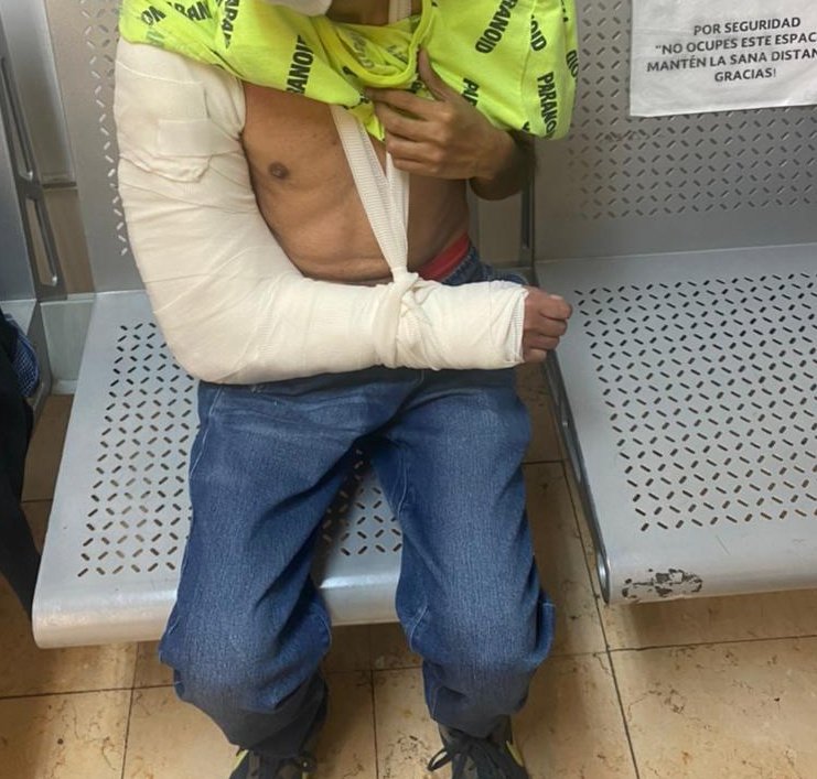 agresioes-policia-cdmx-fractura-personas-sordas
