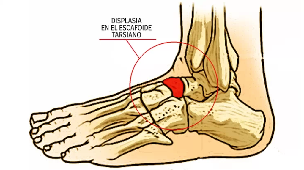 Rafael Nadal lesión rodilla pie