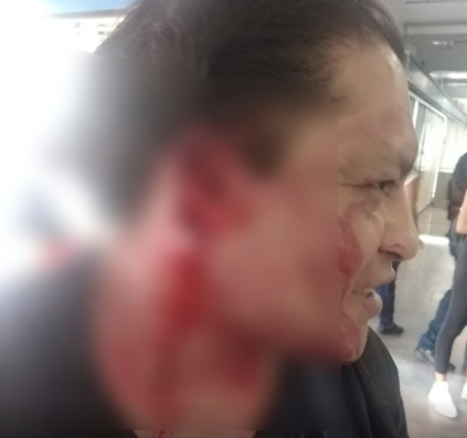 Hombre le arranca la oreja a supuesto acosador en el Metro de la CDMX 