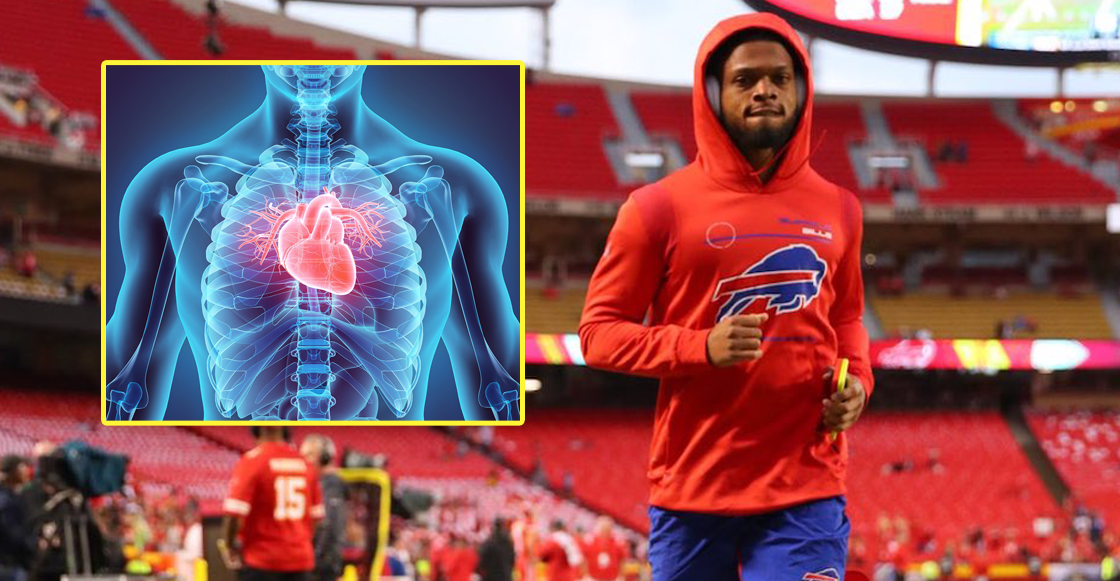 Commotio Cordis, la diferencia entre paro cardíaco e infarto y qué le pasó a Damar Hamlin en la NFL
